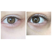 two front shots of female eyes with before and after serum comparison